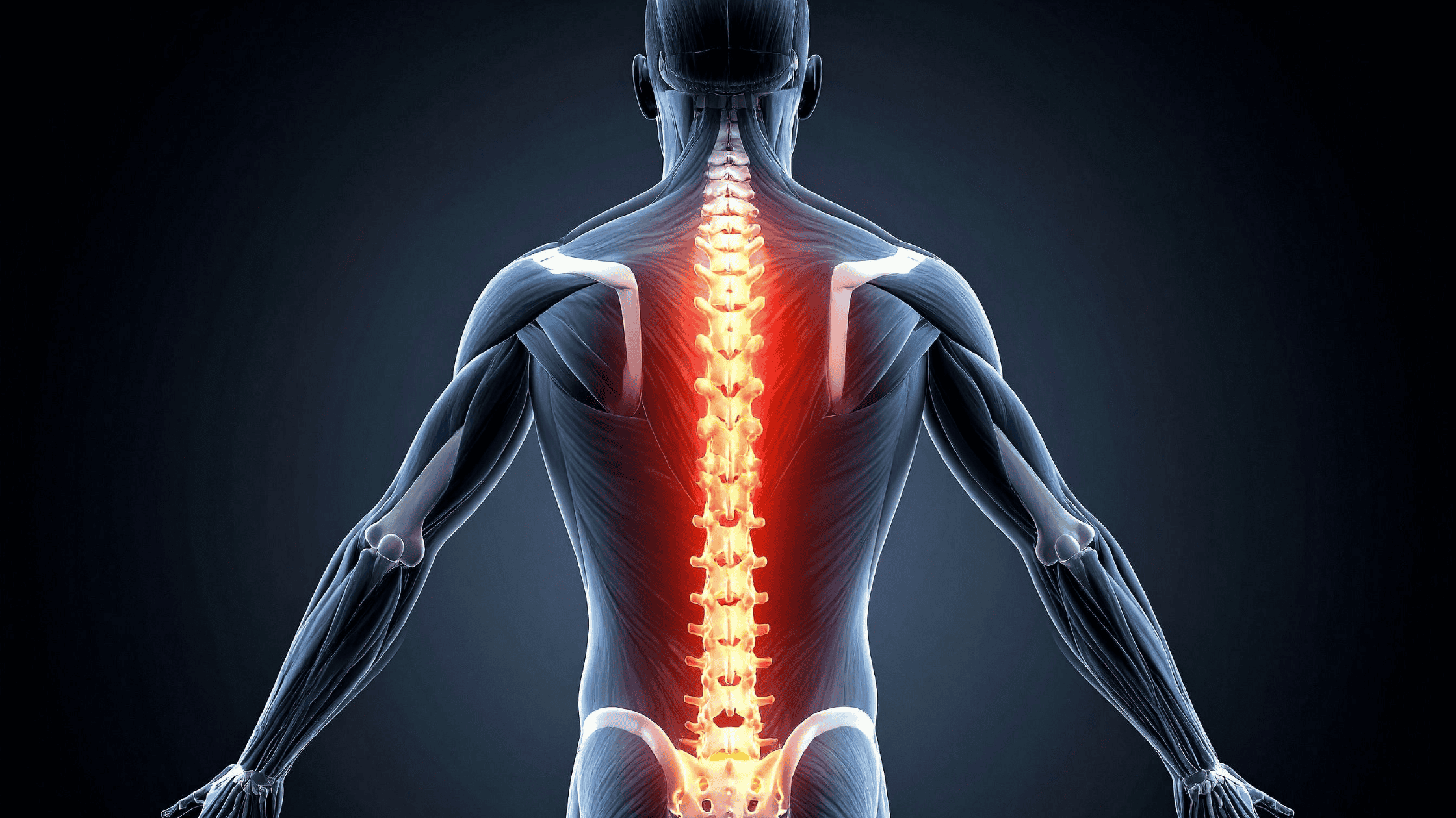 spinal cord stimulator